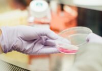 alkoholtests